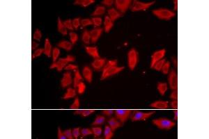 Immunofluorescence analysis of HeLa cells using SLC35A2 Polyclonal Antibody (SLC35A2 anticorps)
