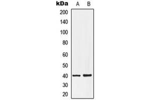Western blot analysis of EDG7 expression in HepG2 (A), NT2D1 (B) whole cell lysates. (LPAR3 anticorps  (C-Term))