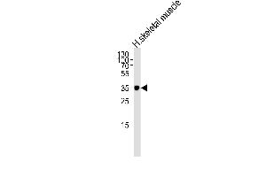 Western blot analysis of lysate from human skeletal muscle tissue lysate, using IFNGR2 Antibody (C-term) (ABIN652277 and ABIN2841159).