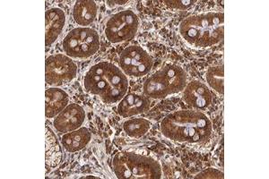 Immunohistochemical staining of human duodenum with ASCC2 polyclonal antibody  shows strong cytoplasmic positivity in glandular cells at 1:20-1:50 dilution. (ASCC2 anticorps)