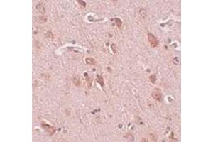 Immunohistochemistry of FAM59B in human brain tissue with FAM59B antibody at 5 μg/ml. (FAM59B anticorps  (C-Term))