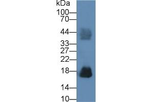Detection of RNASE2 in Human Urine using Polyclonal Antibody to Ribonuclease A2 (RNASE2) (RNASE2 anticorps  (AA 28-161))