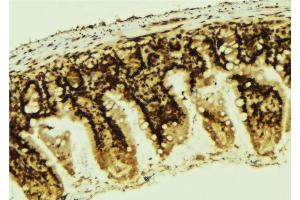 ABIN6267292 at 1/100 staining Mouse colon tissue by IHC-P.