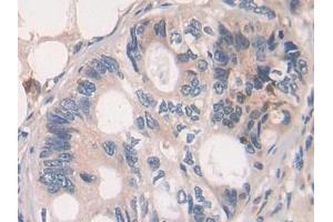 Used in DAB staining on fromalin fixed paraffin- embedded brain tissue (GHRH anticorps  (AA 19-108))