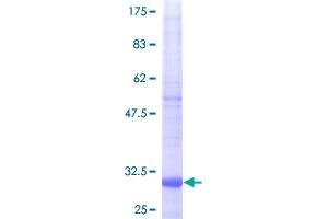 Image no. 1 for NADH Dehydrogenase (Ubiquinone) 1 alpha Subcomplex, 1, 7.5kDa (NDUFA1) (AA 1-70) protein (GST tag) (ABIN1312208)