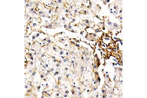 Immunohistochemistry of paraffin-embedded human liver using FBN1 Rabbit pAb (ABIN7267176) at dilution of 1:50 (40x lens).