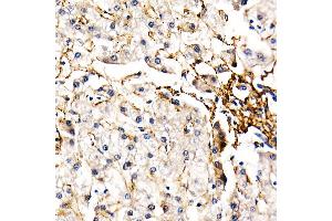Immunohistochemistry of paraffin-embedded human liver using FBN1 Rabbit pAb (ABIN7267176) at dilution of 1:50 (40x lens). (Fibrillin 1 anticorps  (AA 360-460))