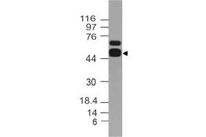 Image no. 1 for anti-Aldehyde Dehydrogenase 1 Family, Member A1 (ALDH1A1) (AA 300-500) antibody (ABIN5027481) (ALDH1A1 anticorps  (AA 300-500))
