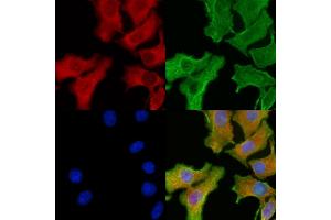 ABIN6260629 and ABIN6276912 staining Hela cells by IF/ICC. (CD47 anticorps  (C-Term))