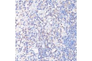 Immunohistochemistry of paraffin-embedded human appendix using CFL1 antibody.