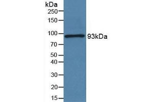 Rabbit Capture antibody from the kit in WB with Positive Control: Sample Human serum.
