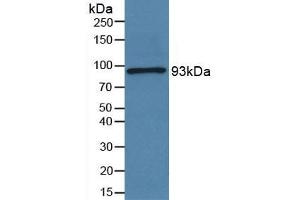 Rabbit Capture antibody from the kit in WB with Positive Control: Sample Human serum. (Periostin Kit ELISA)