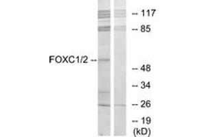 Western blot analysis of extracts from RAW264. (FOXC1 anticorps  (AA 151-200))