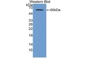 Western Blotting (WB) image for anti-Glucose-6-Phosphate Dehydrogenase (G6PD) (AA 1-515) antibody (ABIN1078069) (Glucose-6-Phosphate Dehydrogenase anticorps  (AA 1-515))