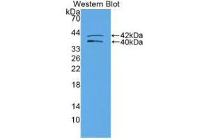 Western blot analysis of recombinant Human IGFBP1. (IGFBPI anticorps  (AA 159-249))