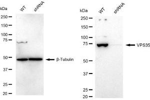 Western blotting analysis using VPS35 antibody (ABIN7800814).
