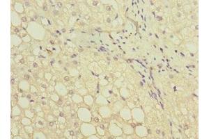 Immunohistochemistry of paraffin-embedded human liver tissue using ABIN7154045 at dilution of 1:100 (GATC anticorps  (AA 1-136))