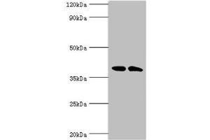 Western blot All lanes: Casein kinase I isoform alpha-like antibody at 4 μg/mL Lane 1: K562 whole cell lysate Lane 2: Hela whole cell lysate Secondary Goat polyclonal to rabbit IgG at 1/10000 dilution Predicted band size: 39 kDa Observed band size: 39 kDa (CSNK1A1L anticorps  (Isoform alpha))
