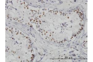 Immunoperoxidase of monoclonal antibody to HDAC1 on formalin-fixed paraffin-embedded human testis. (HDAC1 anticorps  (AA 1-482))