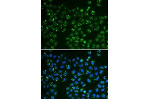 Immunofluorescence analysis of A549 cell using GPX4 antibody.