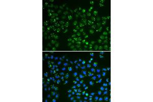 Immunofluorescence analysis of A549 cell using GPX4 antibody. (GPX4 anticorps  (AA 30-197))