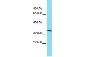 Host: Rabbit Target Name: TMEM241 Sample Type: NCI-H226 Whole Cell lysates Antibody Dilution: 1. (TMEM241 anticorps  (C-Term))