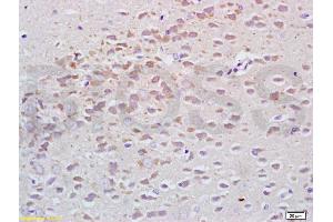 Formalin-fixed and paraffin embedded rat brain tissue labeled with Anti-Tubulin-alpha Polyclonal Antibody, Unconjugated (ABIN725630) at 1:200, followed by conjugation to the secondary antibody and DAB staining (alpha Tubulin anticorps  (AA 375-448))