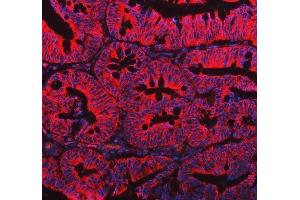 IF analysis of EML4 using anti-EML4 antibody (ABIN6719384). (EML4 anticorps  (AA 207-423))