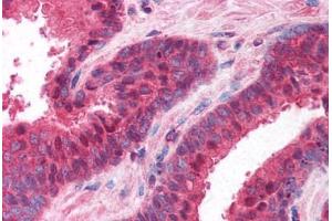 Human Prostate (formalin-fixed, paraffin-embedded) stained with PPP4C antibody ABIN214615 at 10 ug/ml followed by biotinylated goat anti-rabbit IgG secondary antibody ABIN481713, alkaline phosphatase-streptavidin and chromogen. (PPP4C anticorps  (AA 294-307))