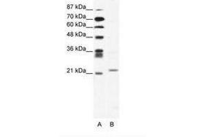 Image no. 1 for anti-Twist Homolog 1 (Drosophila) (TWIST1) (C-Term) antibody (ABIN202060) (TWIST1 anticorps  (C-Term))
