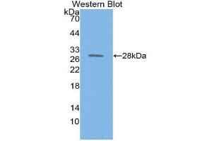 Western Blotting (WB) image for anti-Proteasome 26S Subunit, Non ATPase 9 (AA 2-223) antibody (ABIN1860343) (Proteasome 26S Subunit, Non ATPase 9 (AA 2-223) anticorps)