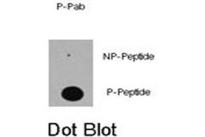 Dot blot analysis of EP300 (phospho S89) polyclonal antibody  on nitrocellulose membrane. (p300 anticorps  (pSer89))