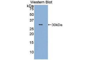 Western Blotting (WB) image for anti-DNA Fragmentation Factor, 40kDa, beta Polypeptide (Caspase-Activated DNase) (DFFB) (AA 87-323) antibody (ABIN1858217)