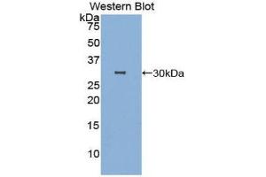 Western Blotting (WB) image for anti-DNA Fragmentation Factor, 40kDa, beta Polypeptide (Caspase-Activated DNase) (DFFB) (AA 87-323) antibody (ABIN3207309) (DFFB anticorps  (AA 87-323))