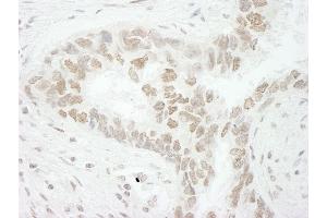 Immunohistochemistry (IHC) image for anti-CD3e Molecule, epsilon Associated Protein (CD3EAP) (AA 404-454) antibody (ABIN7448916) (CD3EAP anticorps  (AA 404-454))