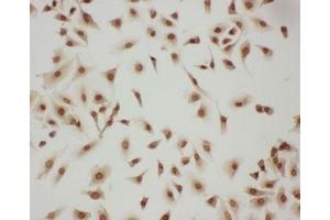 ICC testing of LASP1 antibody and A549 cells