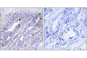 Immunohistochemistry (IHC) image for anti-Nuclear Receptor Subfamily 4, Group A, Member 1 (NR4A1) (AA 317-366) antibody (ABIN2888917) (NR4A1 anticorps  (AA 317-366))