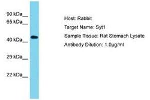 Image no. 1 for anti-Synaptotagmin I (SYT1) (AA 104-153) antibody (ABIN6750420) (SYT1 anticorps  (AA 104-153))