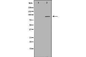 Western blot analysis of Hela whole cell lysates, using UHRF1  Antibody.