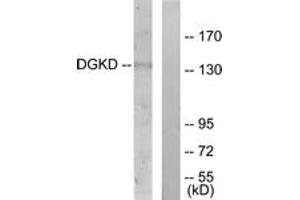 Western blot analysis of extracts from HuvEc cells, using DGKD Antibody.