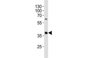Western blot analysis of lysate from human spleen tissue lysate using CD40 antibody diluted at 1:1000.