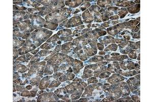 Immunohistochemical staining of paraffin-embedded Kidney tissue using anti-ACSBG1 mouse monoclonal antibody. (ACSBG1 anticorps)