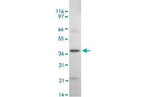 Western blot analysis of DAPK2 in rat kidney tissue lysate using DAPK2 polyclonal antibody  at 2 ug/mL . (DAPK2 anticorps  (AA 325-342))