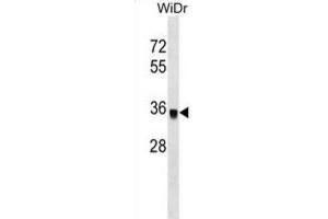 Western Blotting (WB) image for anti-Protein Phosphatase 1, Catalytic Subunit, gamma Isoform (PPP1CC) antibody (ABIN2999122)
