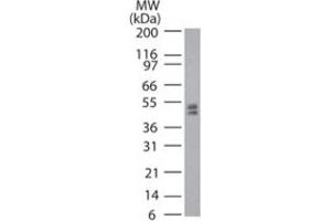 Western blot analysis of Trdmt1 in mouse ES cell lysate using Trdmt1 polyclonal antibody  at 2 ug/mL . (Dnmt2 anticorps  (AA 39-53))