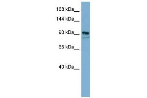 FAM62B antibody used at 1 ug/ml to detect target protein. (FAM62B anticorps)