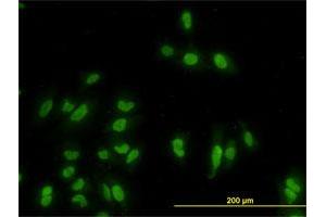 Immunofluorescence of monoclonal antibody to GATA2 on HeLa cell.