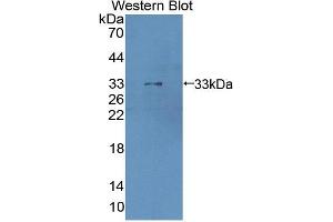 Western blot analysis of the recombinant protein. (Cathepsin Z anticorps  (AA 34-291))