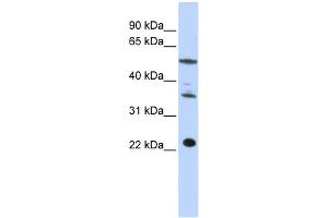 WB Suggested Anti-CENPM Antibody Titration:  0. (CENPM anticorps  (Middle Region))