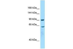 WB Suggested Anti-WHAMM Antibody Titration: 1.
